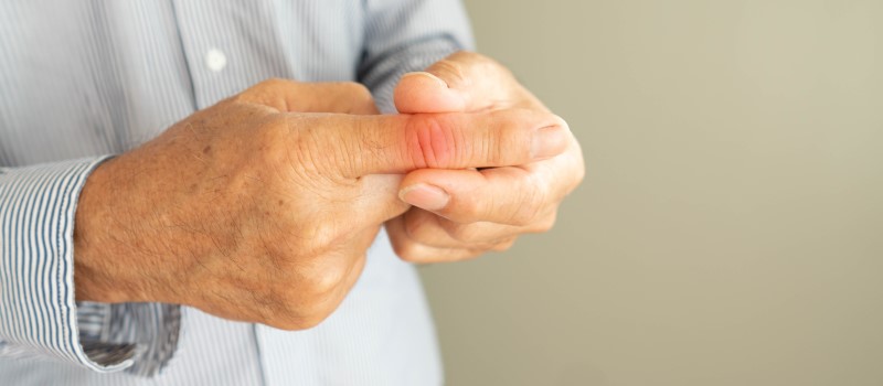 Stłuczony palec – objawy, pierwsza pomoc, leczenie